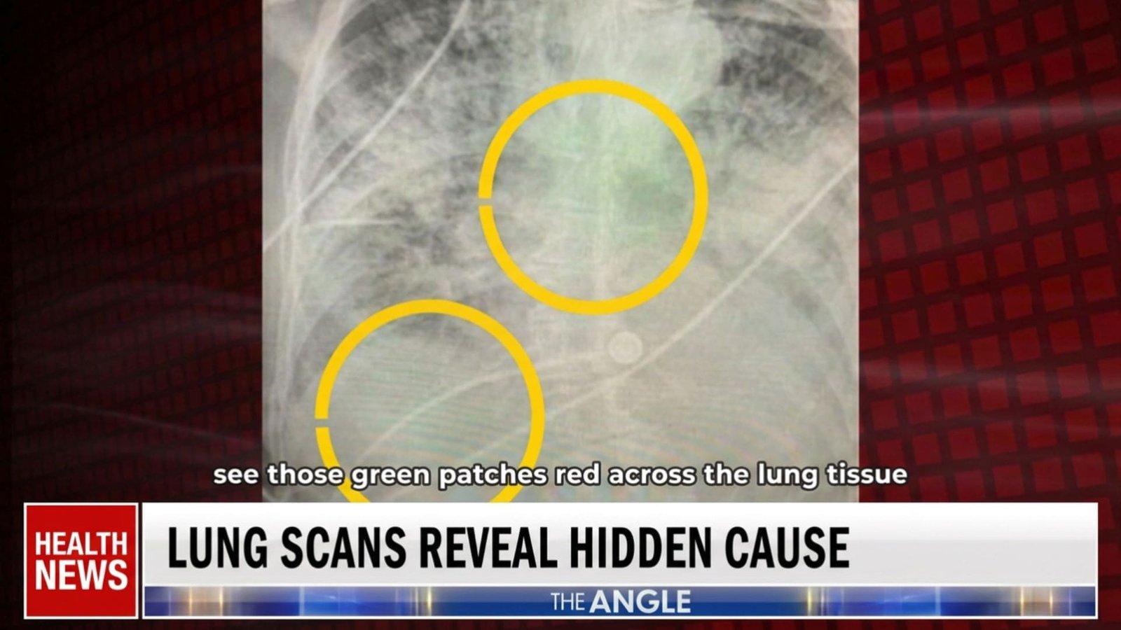 What researchers are finding about the airways and breathing